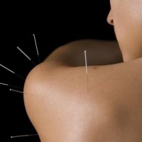 Acupuncture & Chinese Medicine
